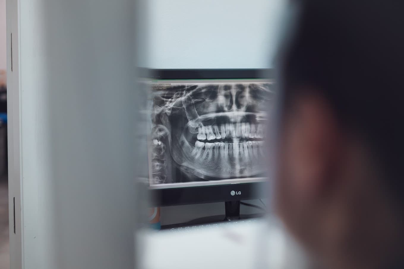Radiografía dental en pantalla