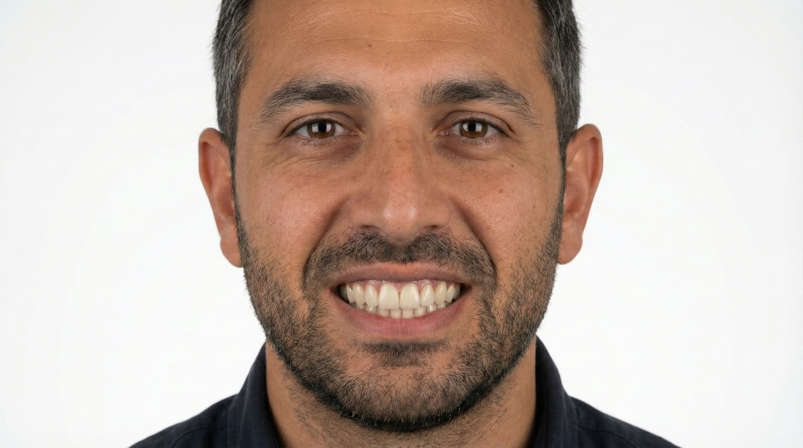 Recuperación de pieza dental - Antes